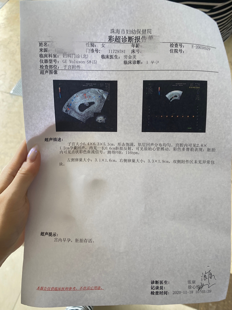 孕6周 1天 b超单 这是我怀2胎宝宝了 一胎是男