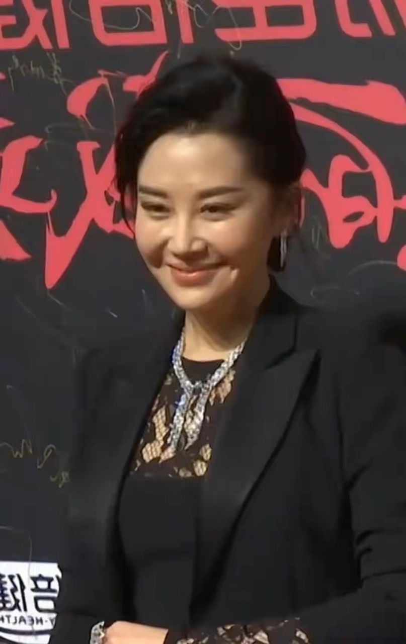 许晴是不是也开始医美了?脸僵硬了不少啊