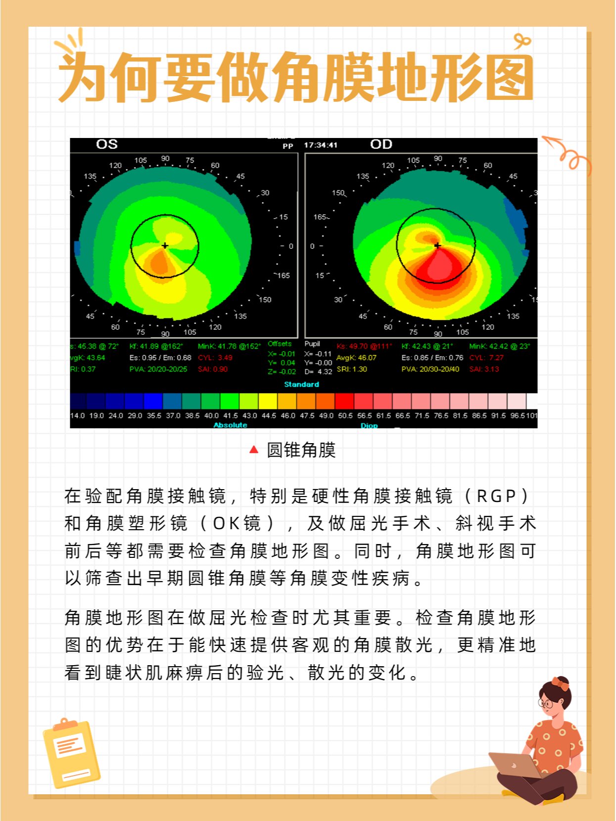 角膜地形图的作用图片