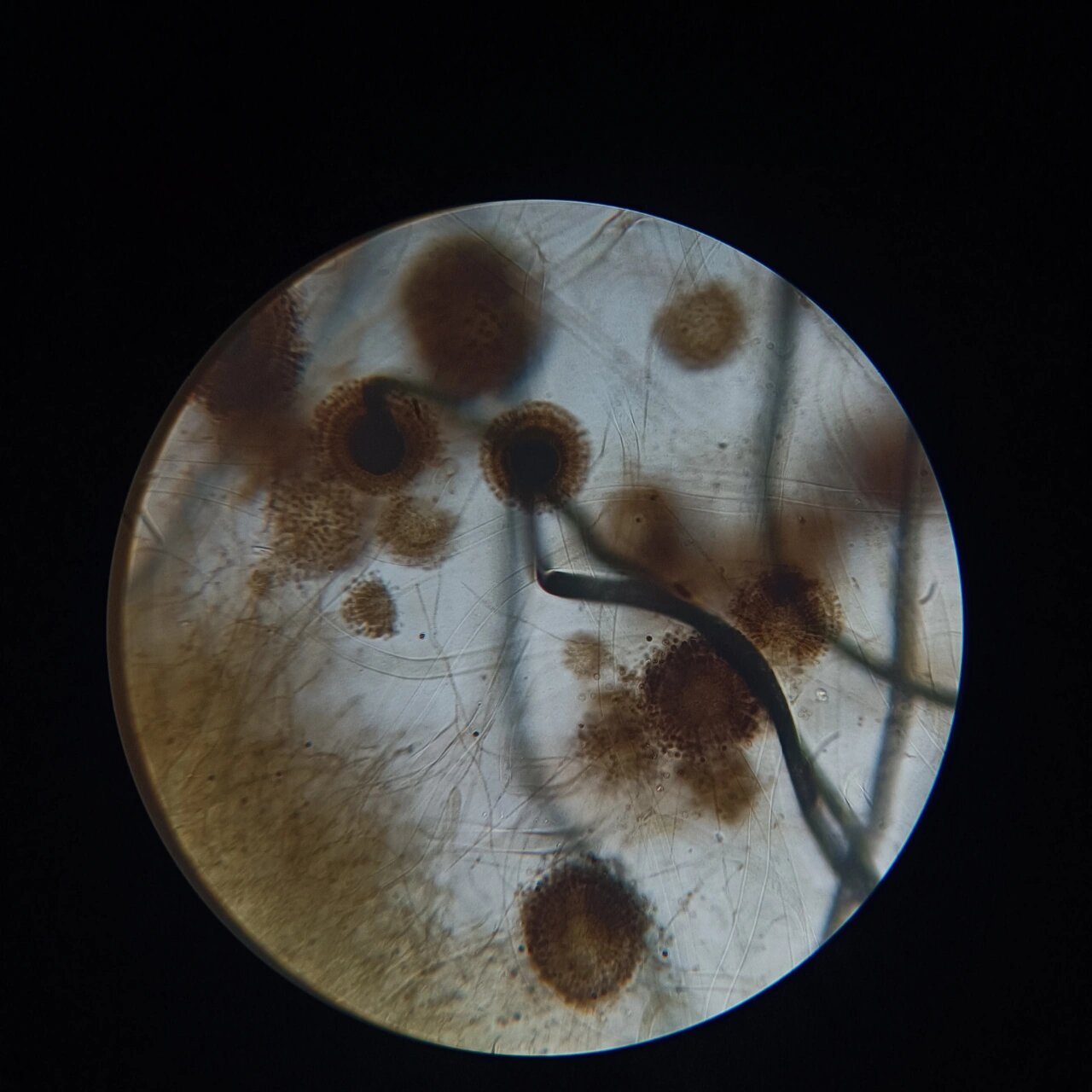 显微镜下的曲霉菌图片