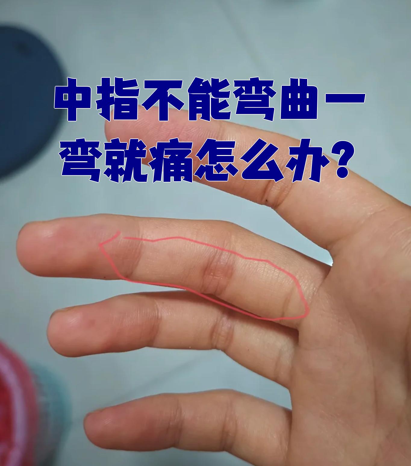中指不能弯曲,一弯就痛,常见原因有外伤,腱鞘炎,滑膜炎等