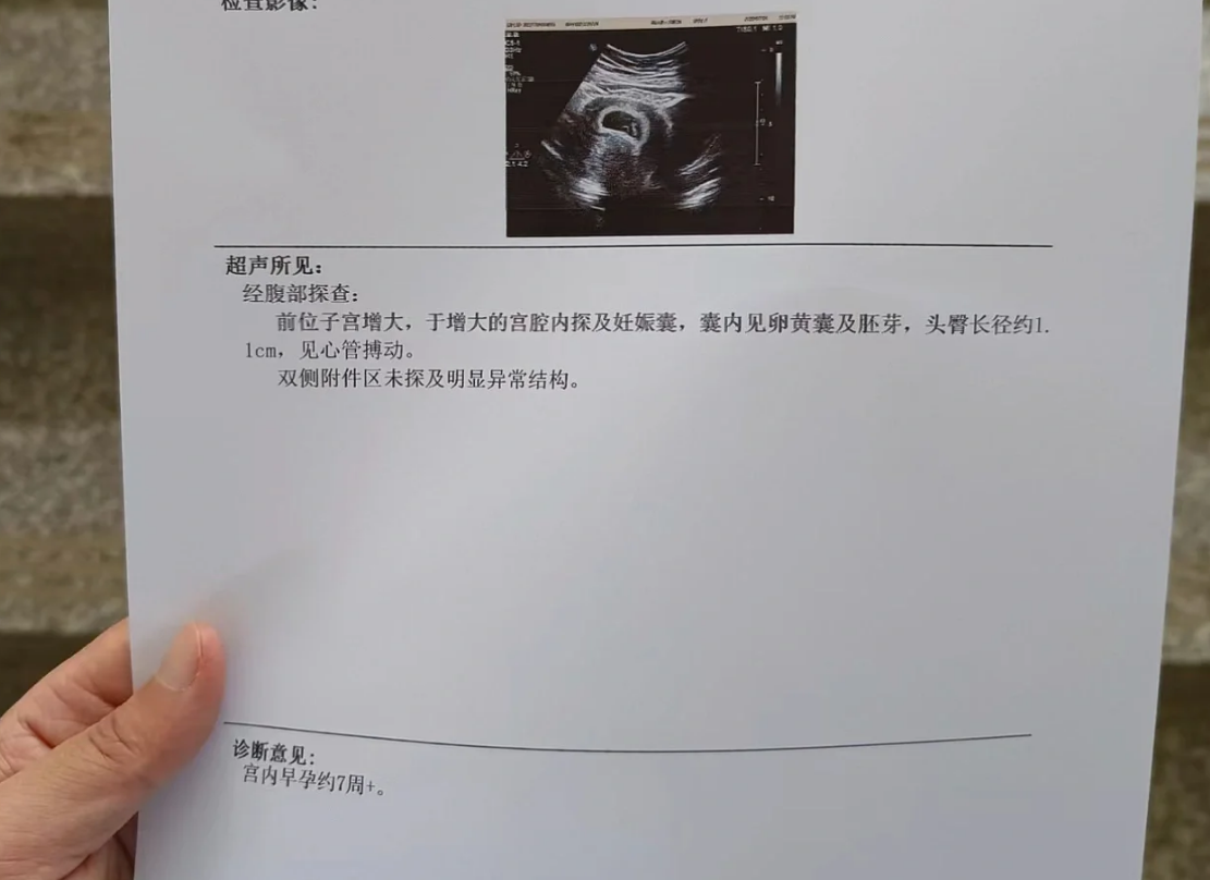 怀孕6周后就可以建卡了,但最好在13周前完成