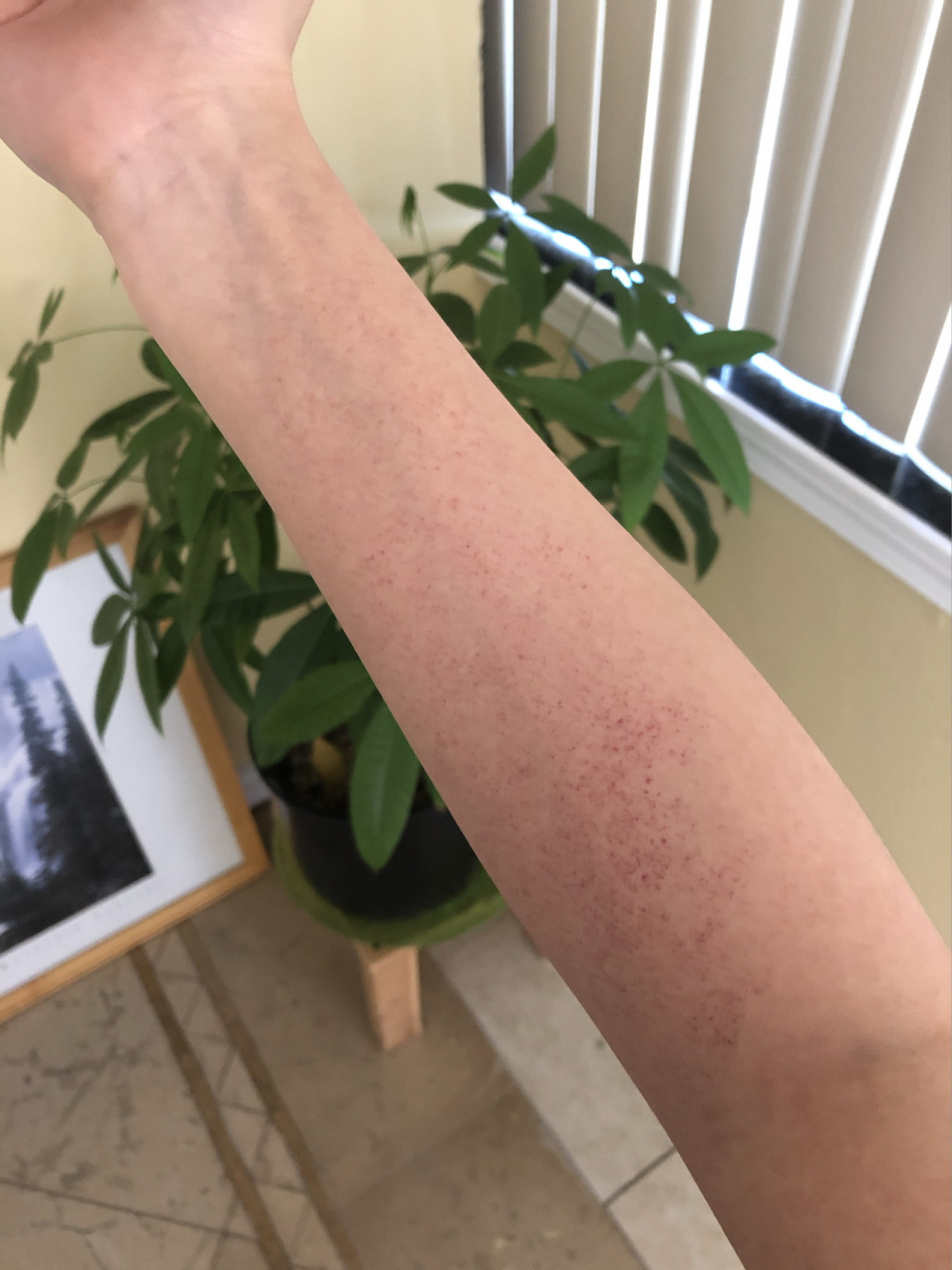 身上突然出现一片红点是怎么回事 想请教下小红书的宝宝有知道胳膊或