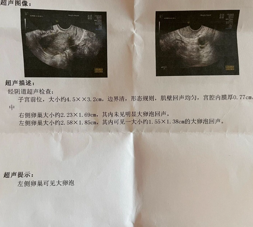 阴超能查出很多妇科问题