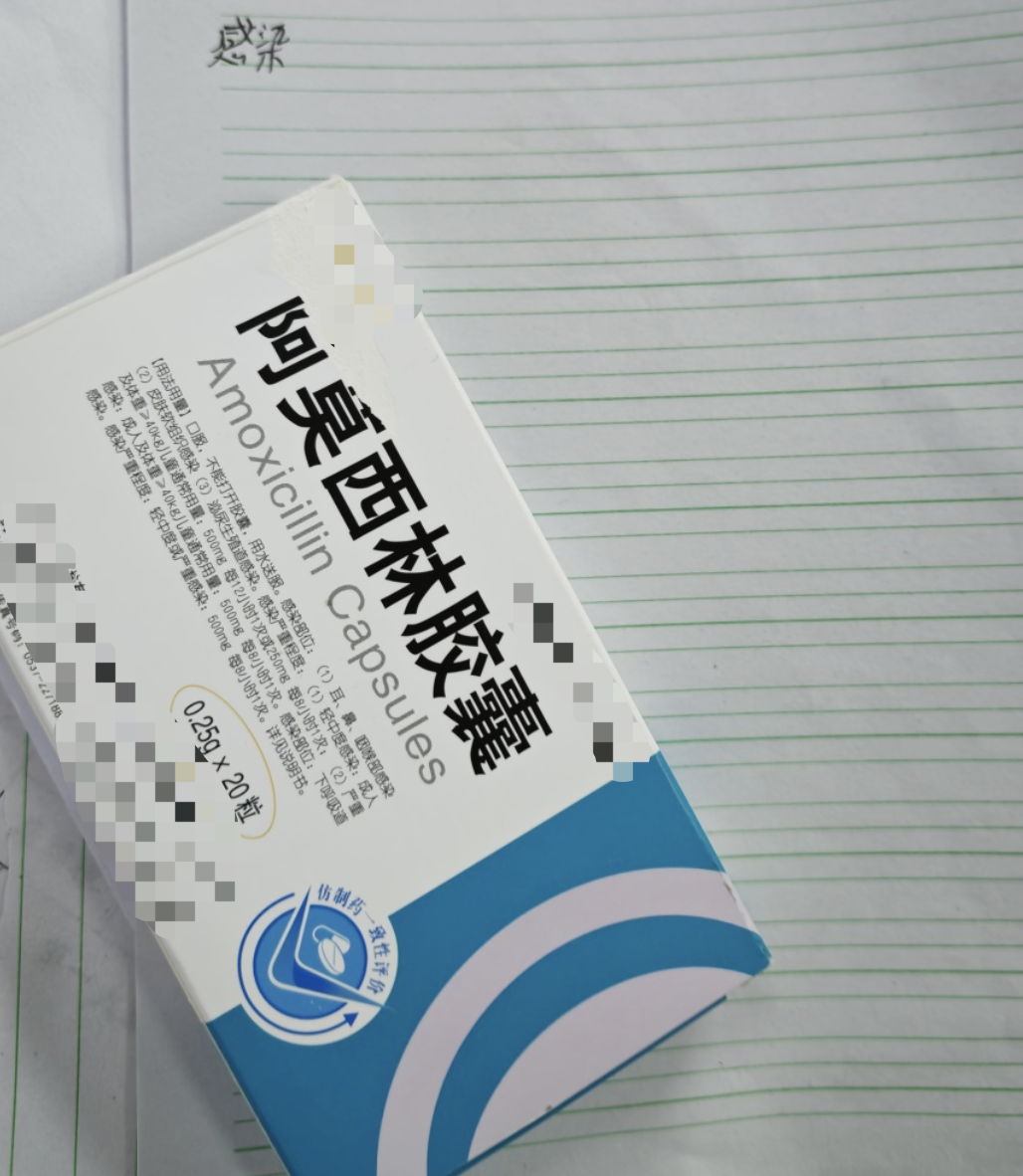 嗓子旁边出现白色物质,最常见的原因是急性化脓性