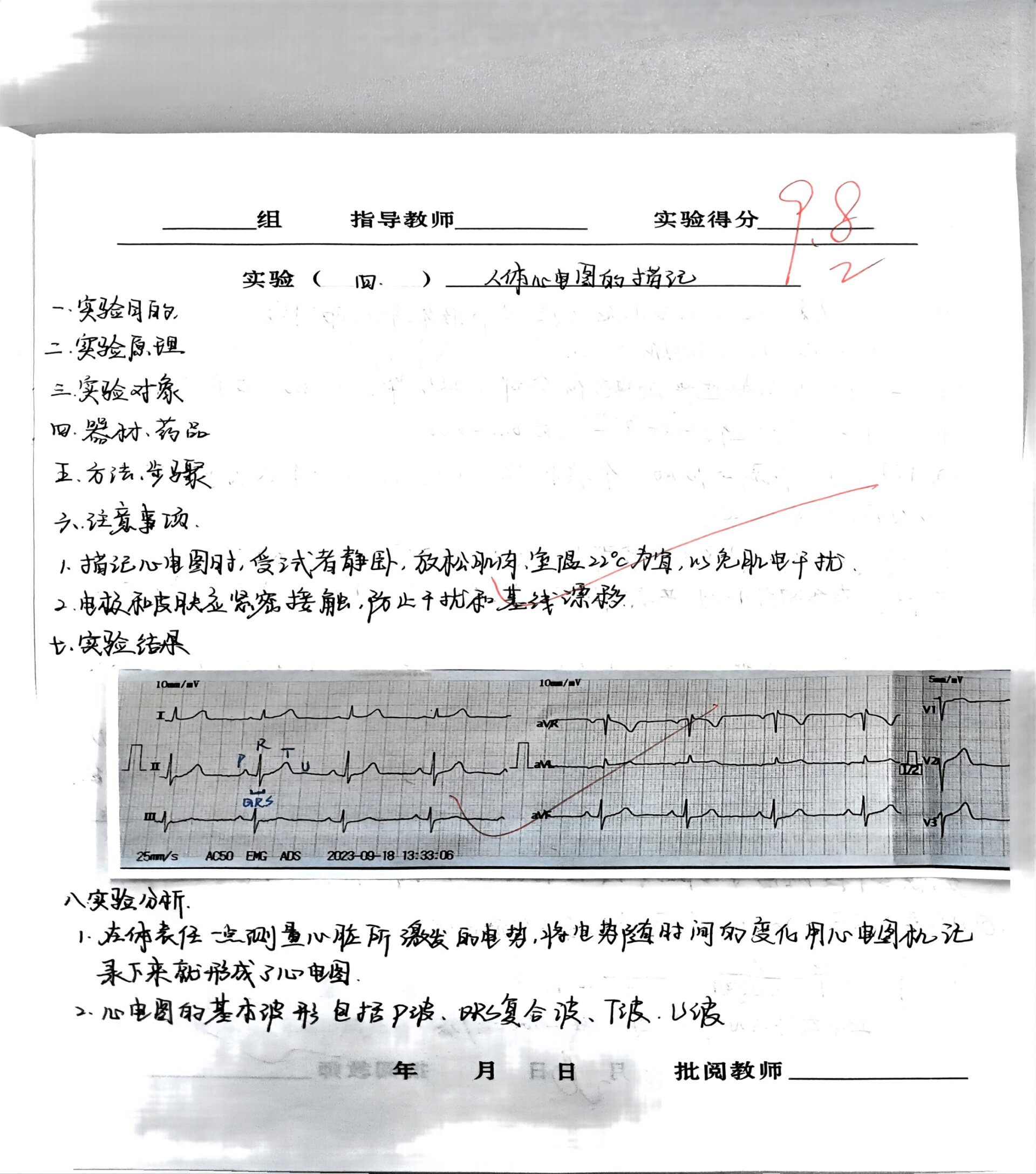 心电图测量实验报告图片