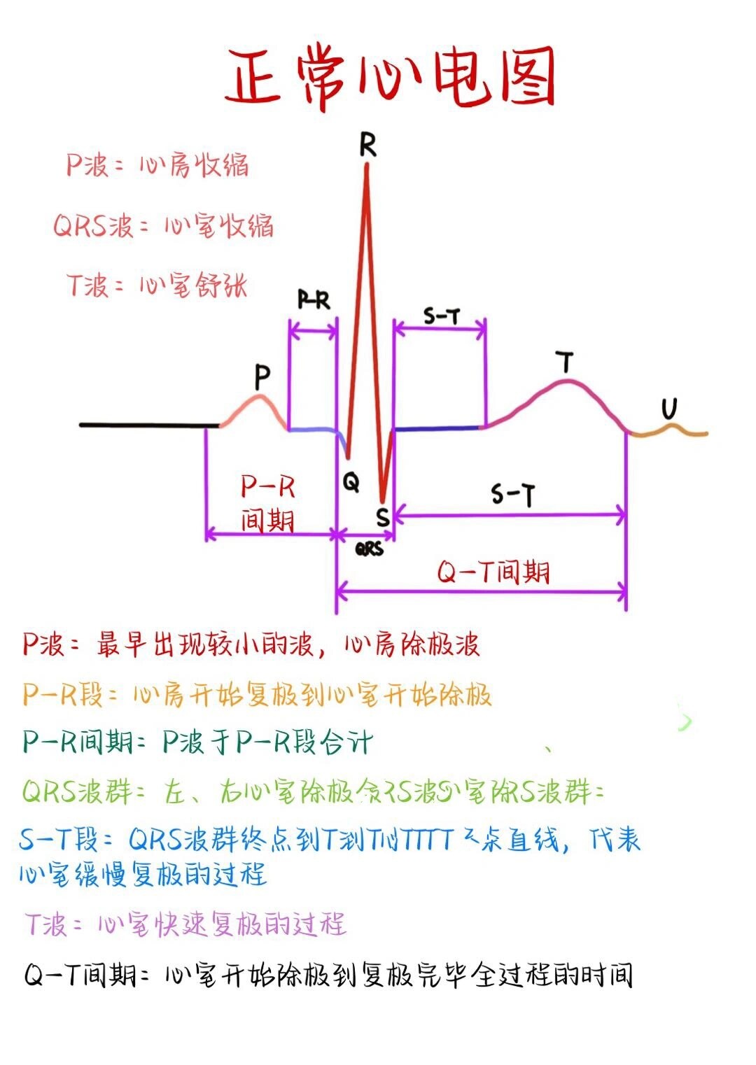 正常人的心率图图片