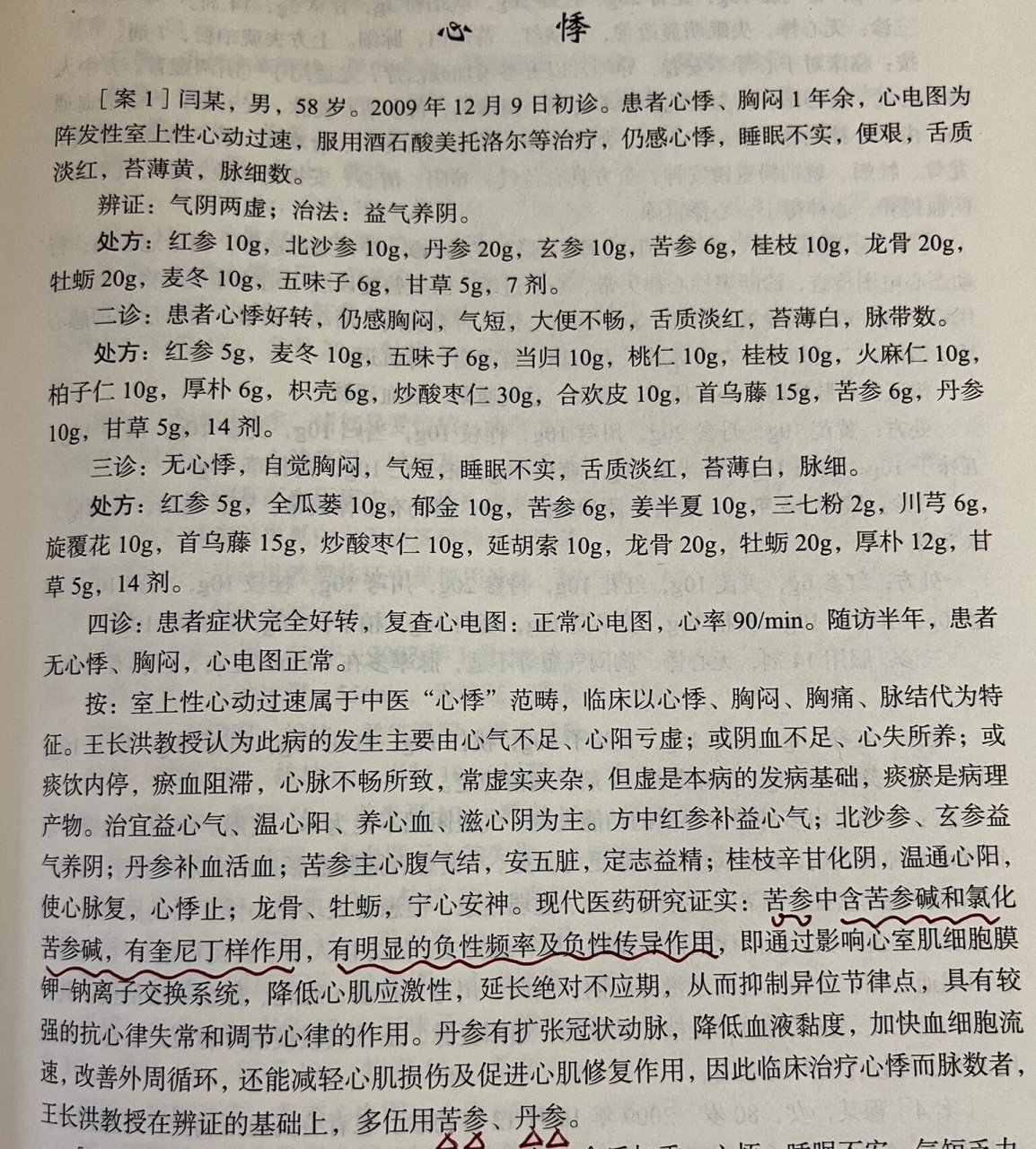 中医心悸病临床经验方 分享一个王长洪国家名医的临床治疗心悸(西医