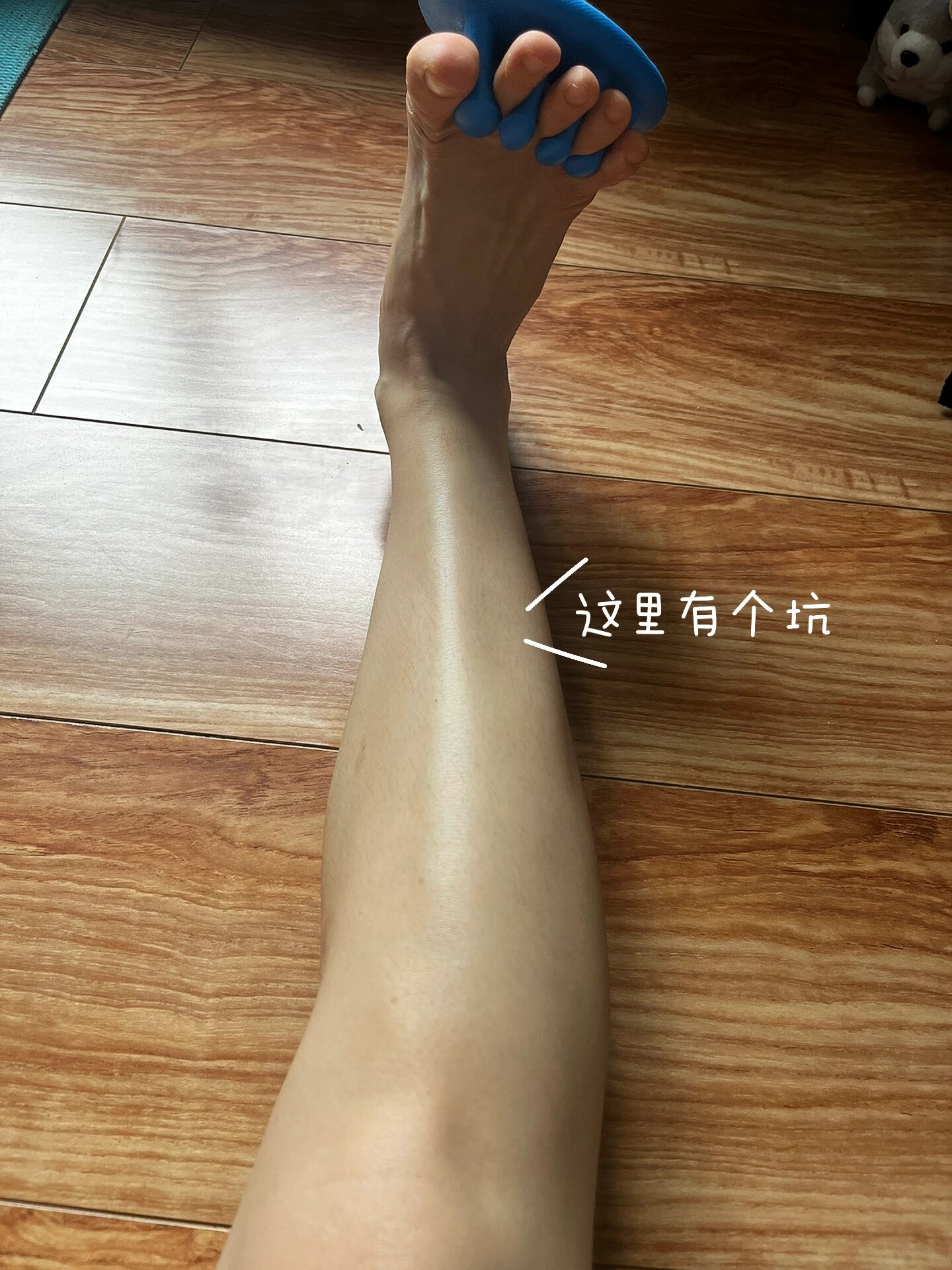 小腿右前侧 勾脚时候有大坑咋回事