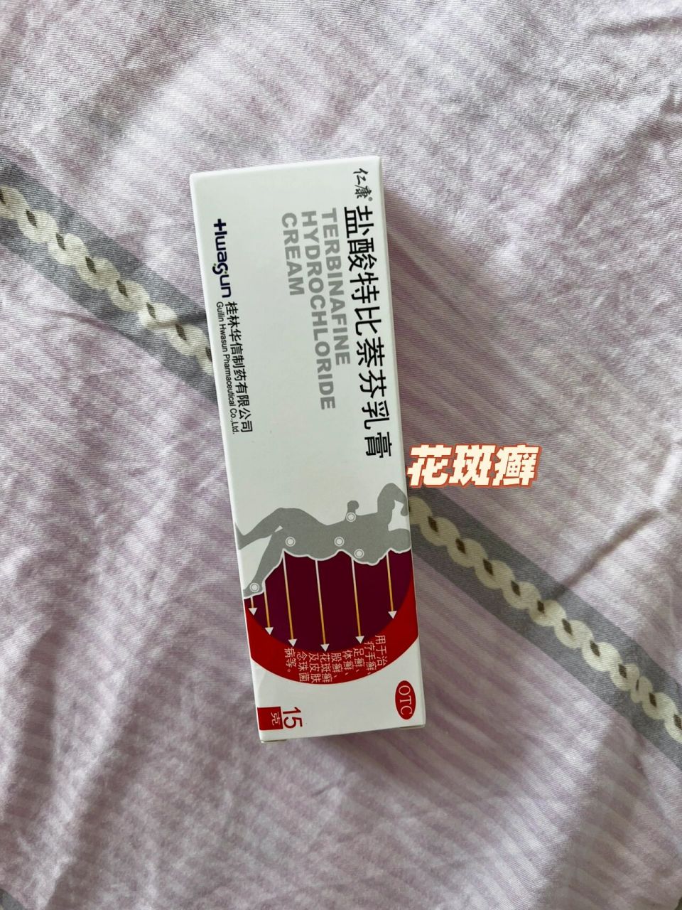 婴幼儿花斑癣 宝宝最近五天额头有白斑,今天带她去看,医生说是"花斑癣