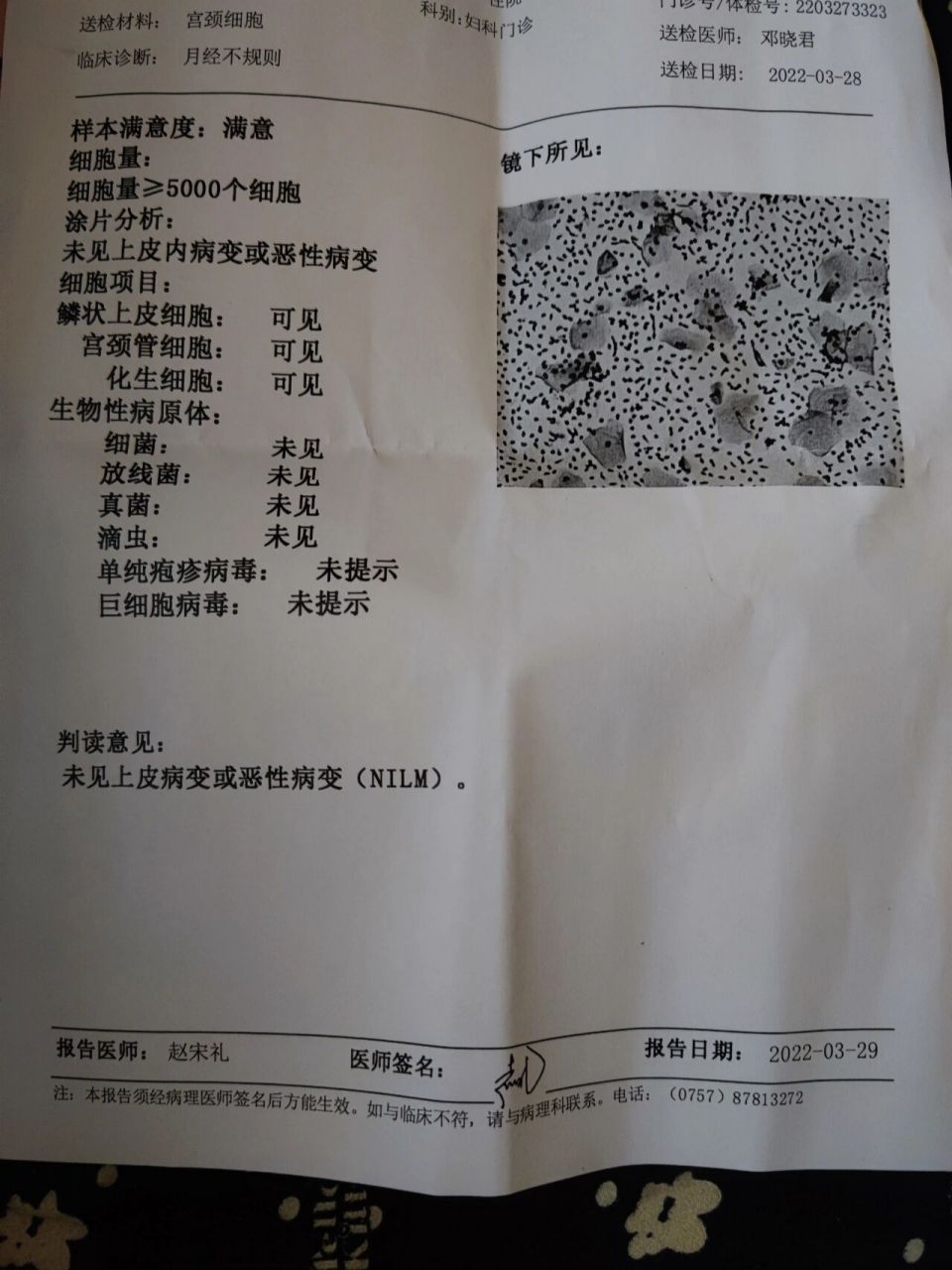 化生细胞,鳞状上皮细胞可见是什么意思,给医生看又说没事,可是自己搜