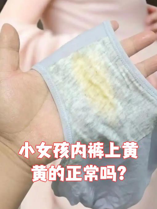 小女孩内裤上黄黄的正常吗?