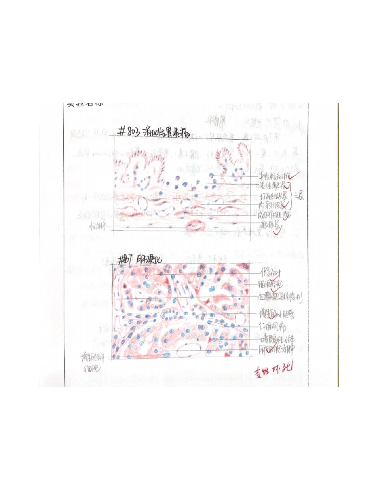 胃溃疡红蓝铅笔图图片