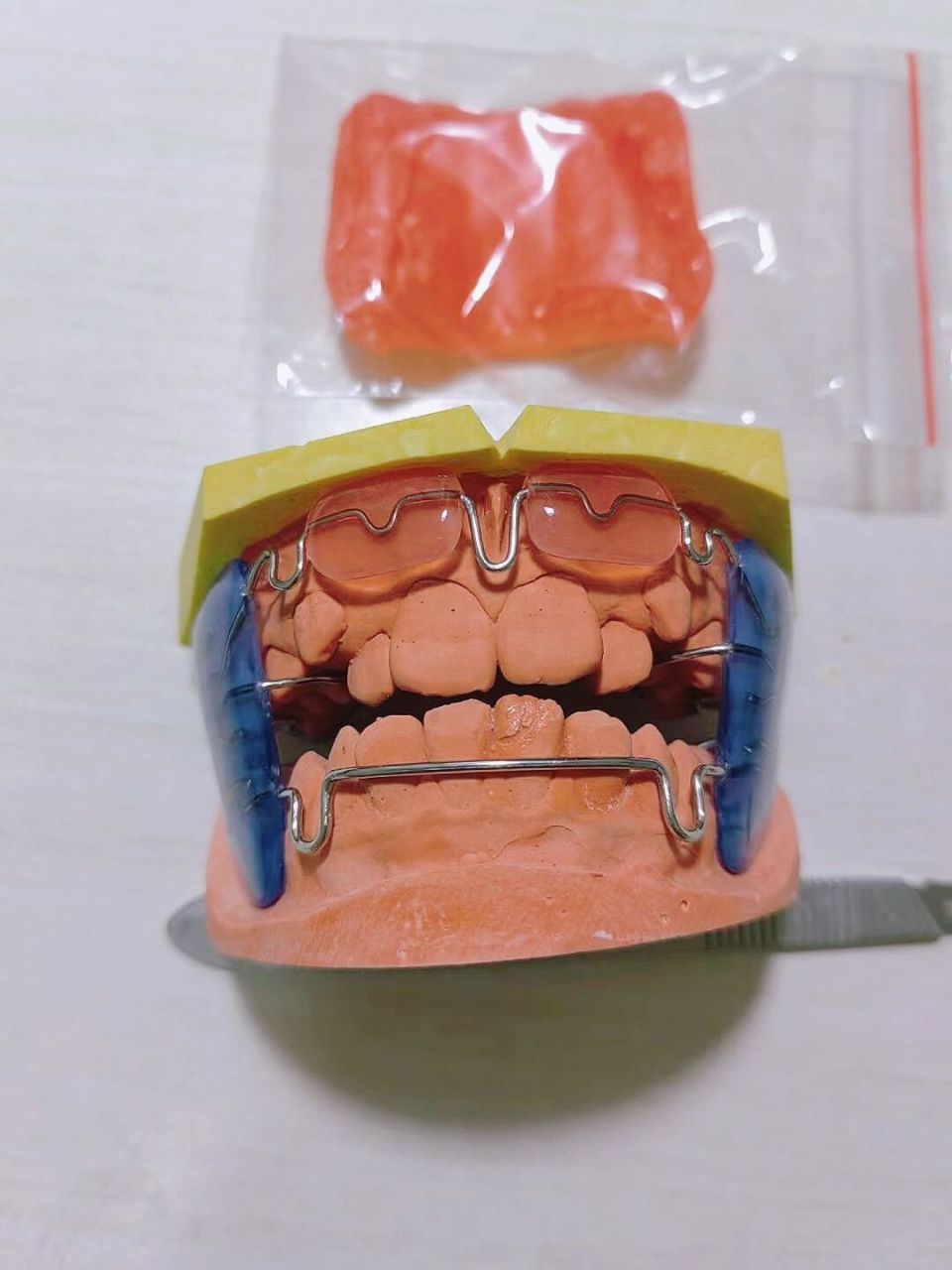 地包天通常戴的几款矫治器,大家可提问