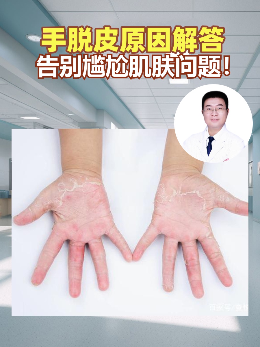 皮肤为什么脱皮