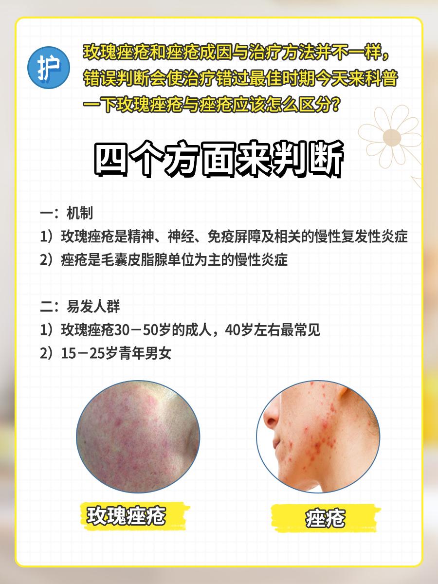 的想法: 从四个方面根本分清玫瑰痤疮vs痤疮治疗 | 今天就来科普一下