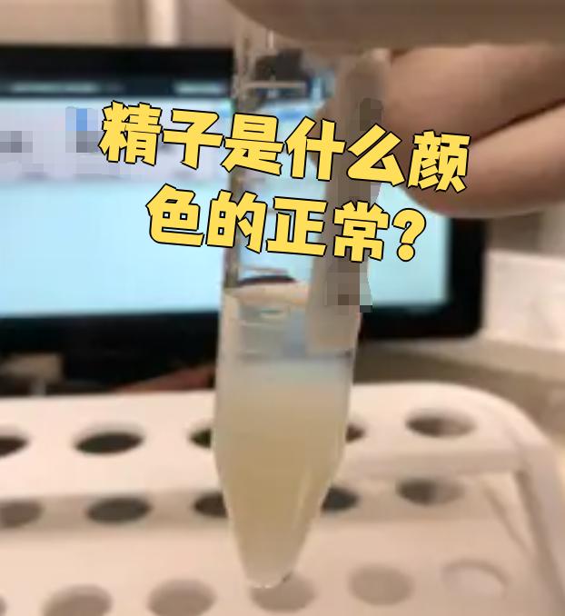 关于为什么射出来的精子是黄色的的信息