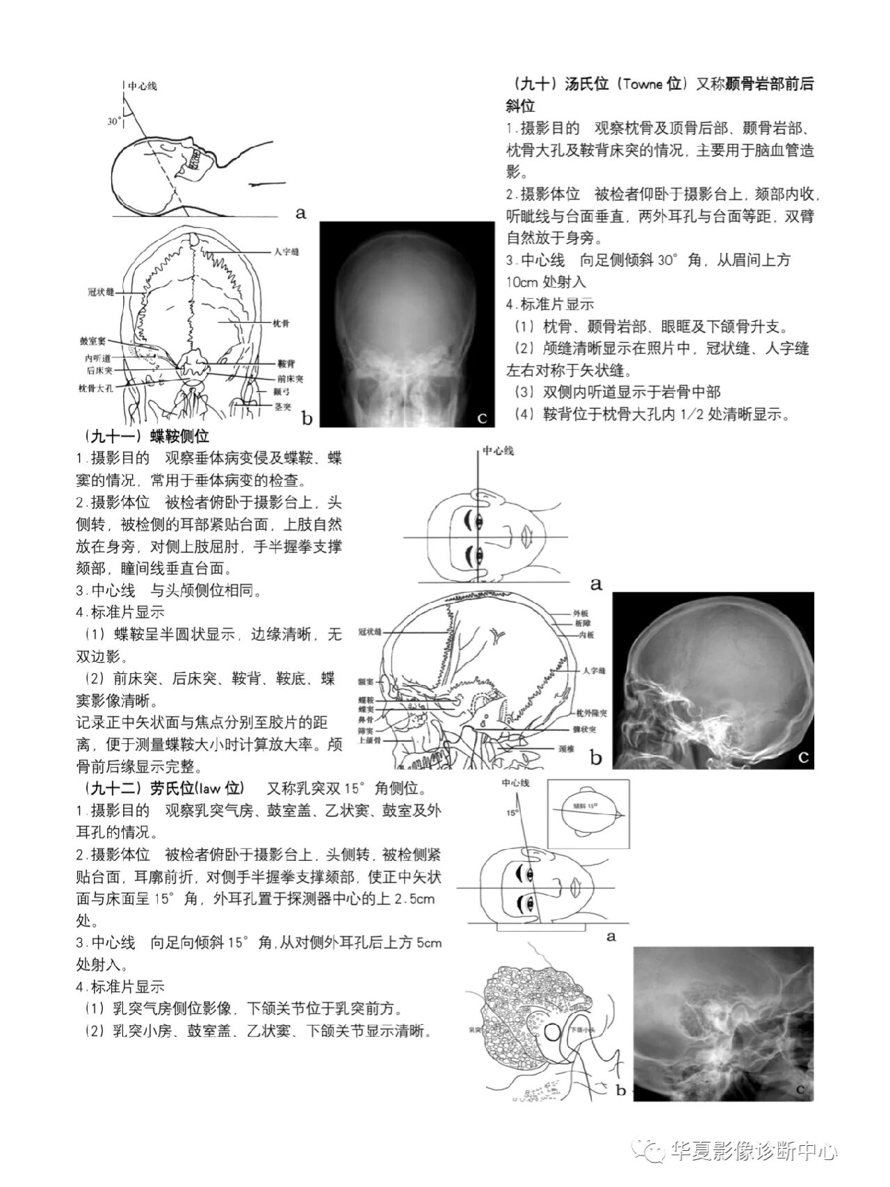 顶颌位的图解图片