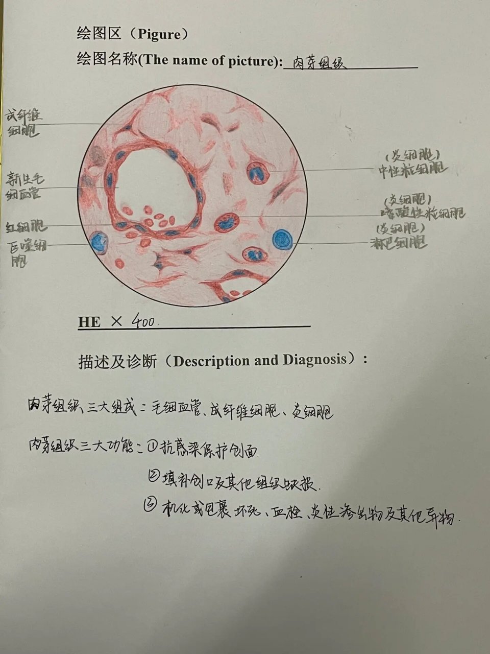 肉芽组织 病理学 肉芽组织红蓝铅笔手绘