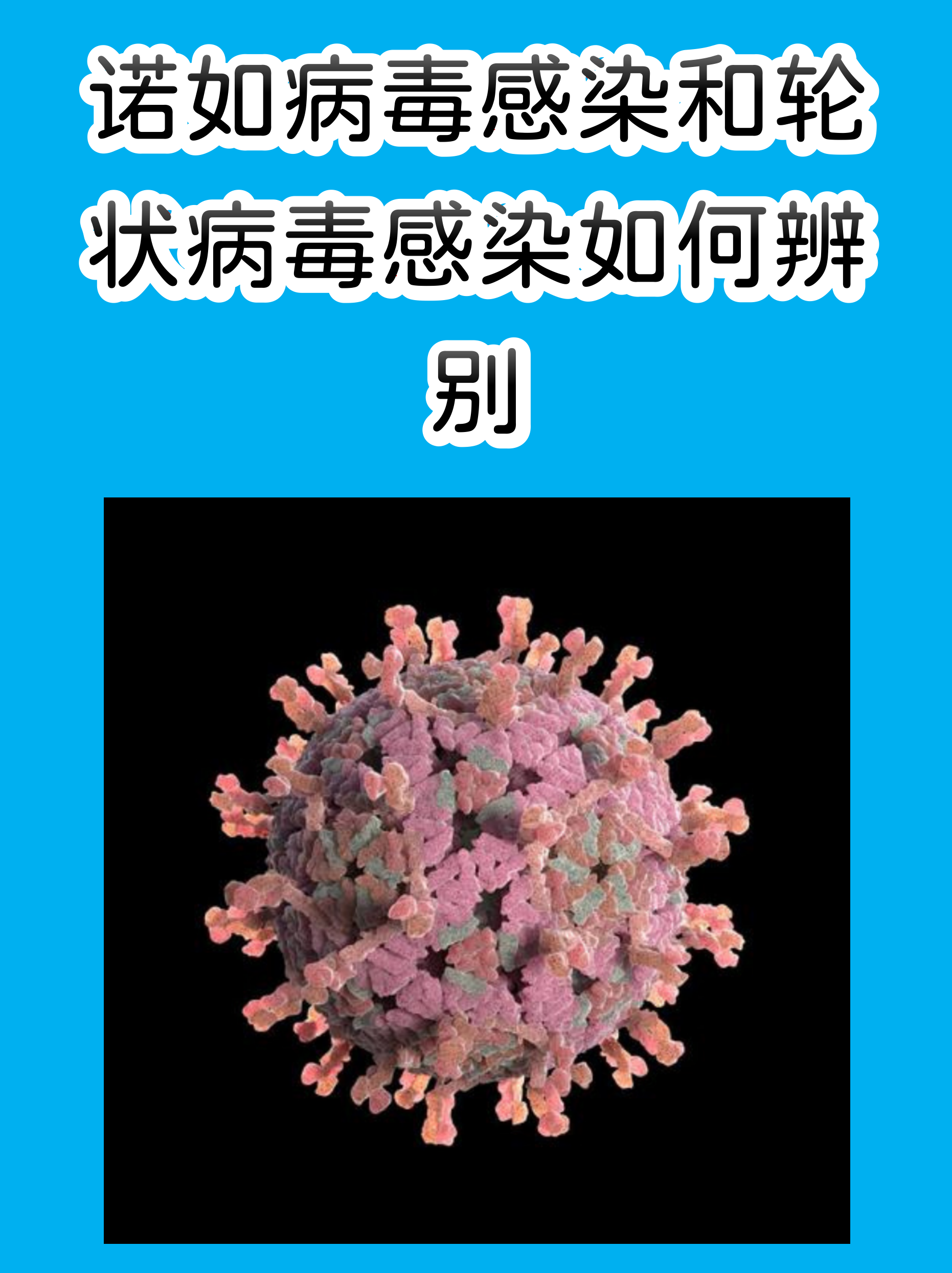  拉肚子的病毒有哪些(拉肚子有哪些病毒感染)
