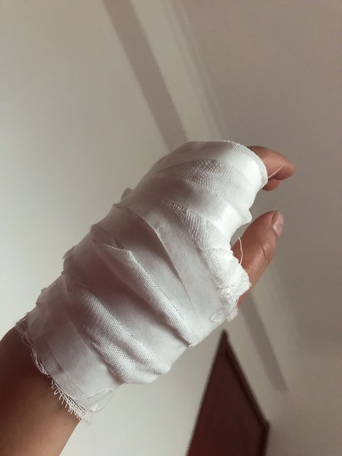 打了破伤风多久可以母乳 今天不小心被美工刀划伤了,缝了3针,医生让打