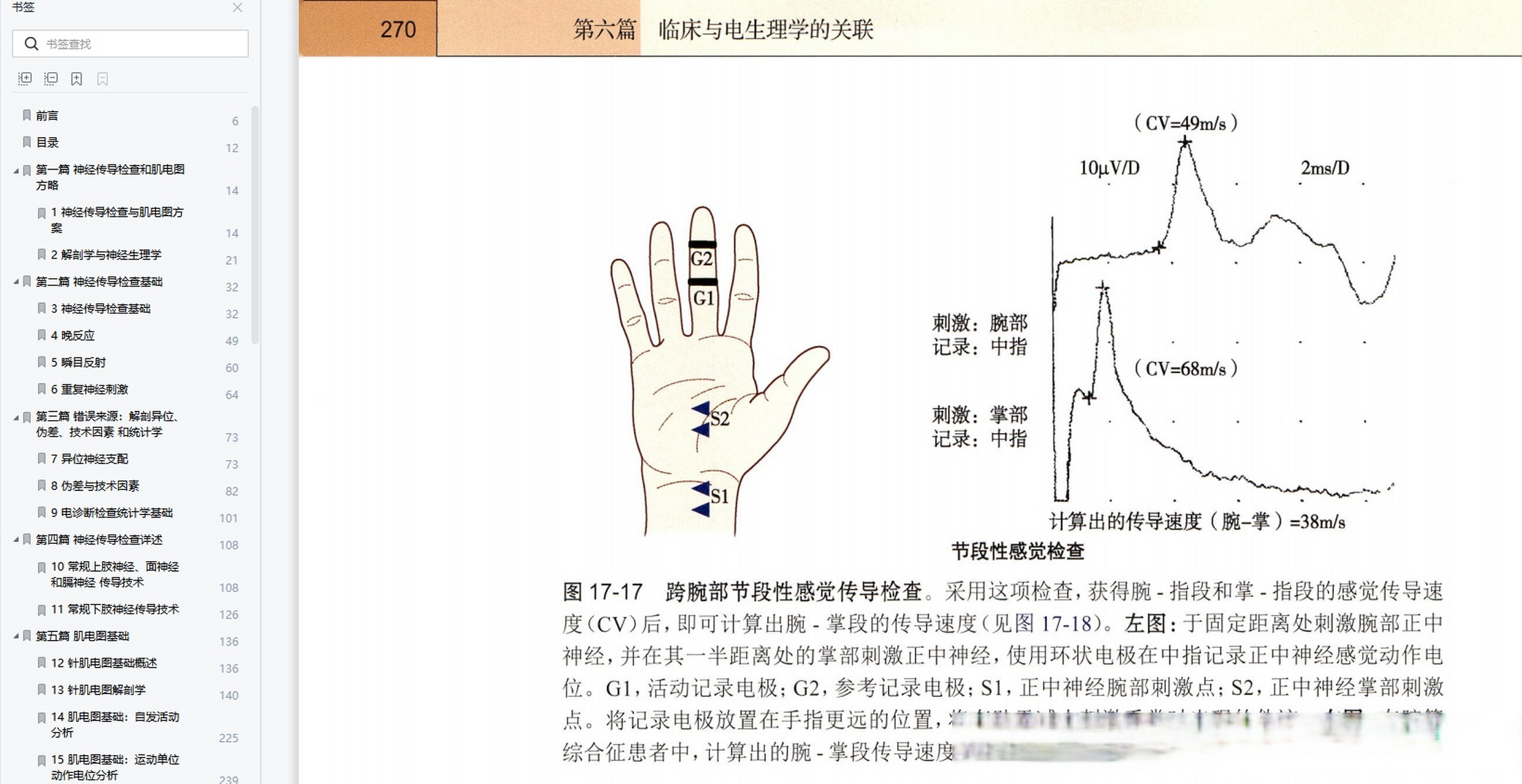 神经肌电图多少钱图片