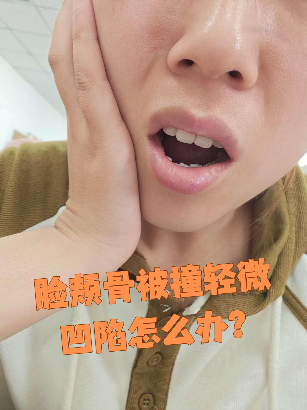 先去医院拍个x光片,看看有没有骨折