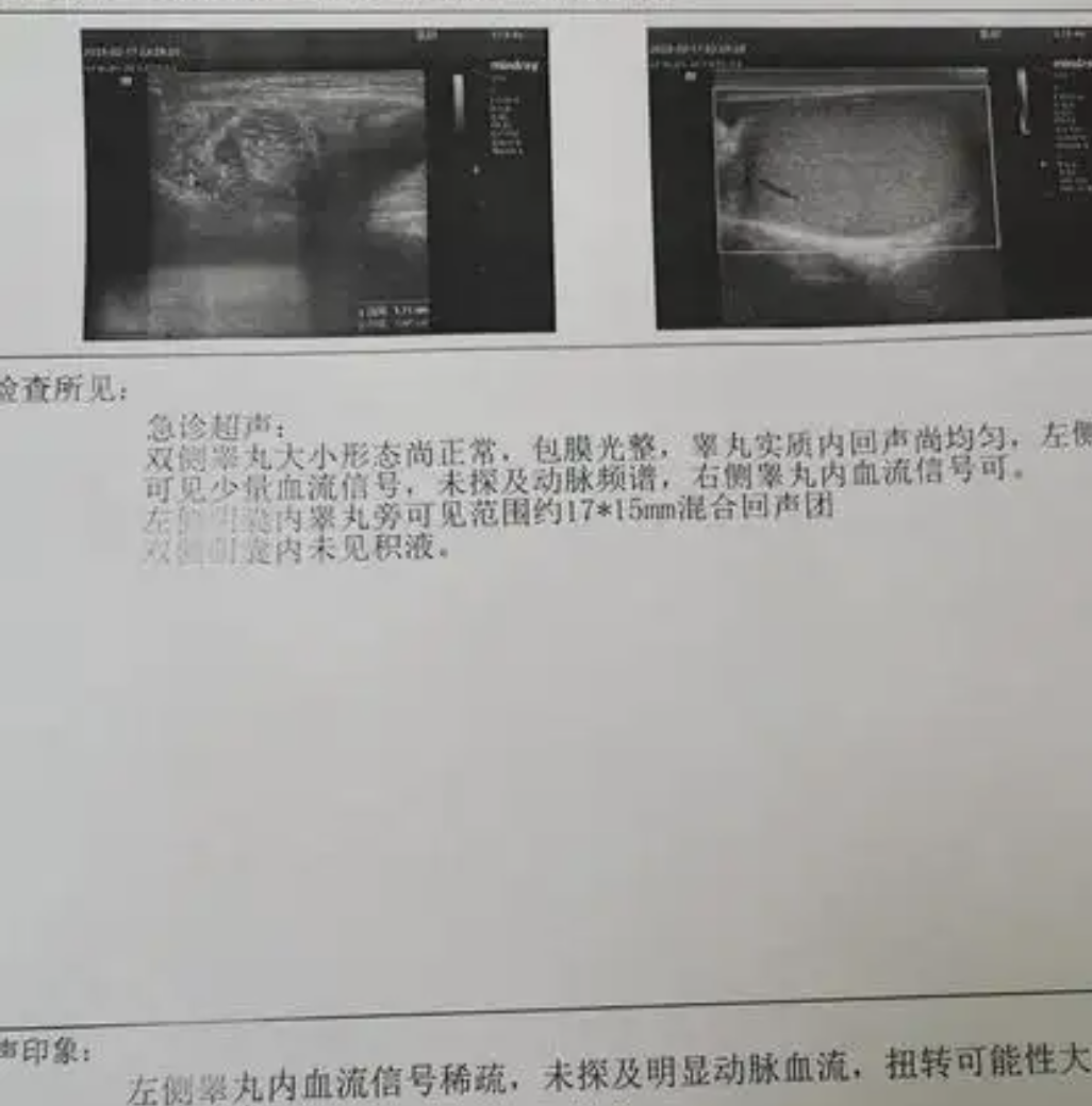 包括正常生理现象或疾病问题,比如睾丸外伤,睾丸静脉曲张,睾丸扭转