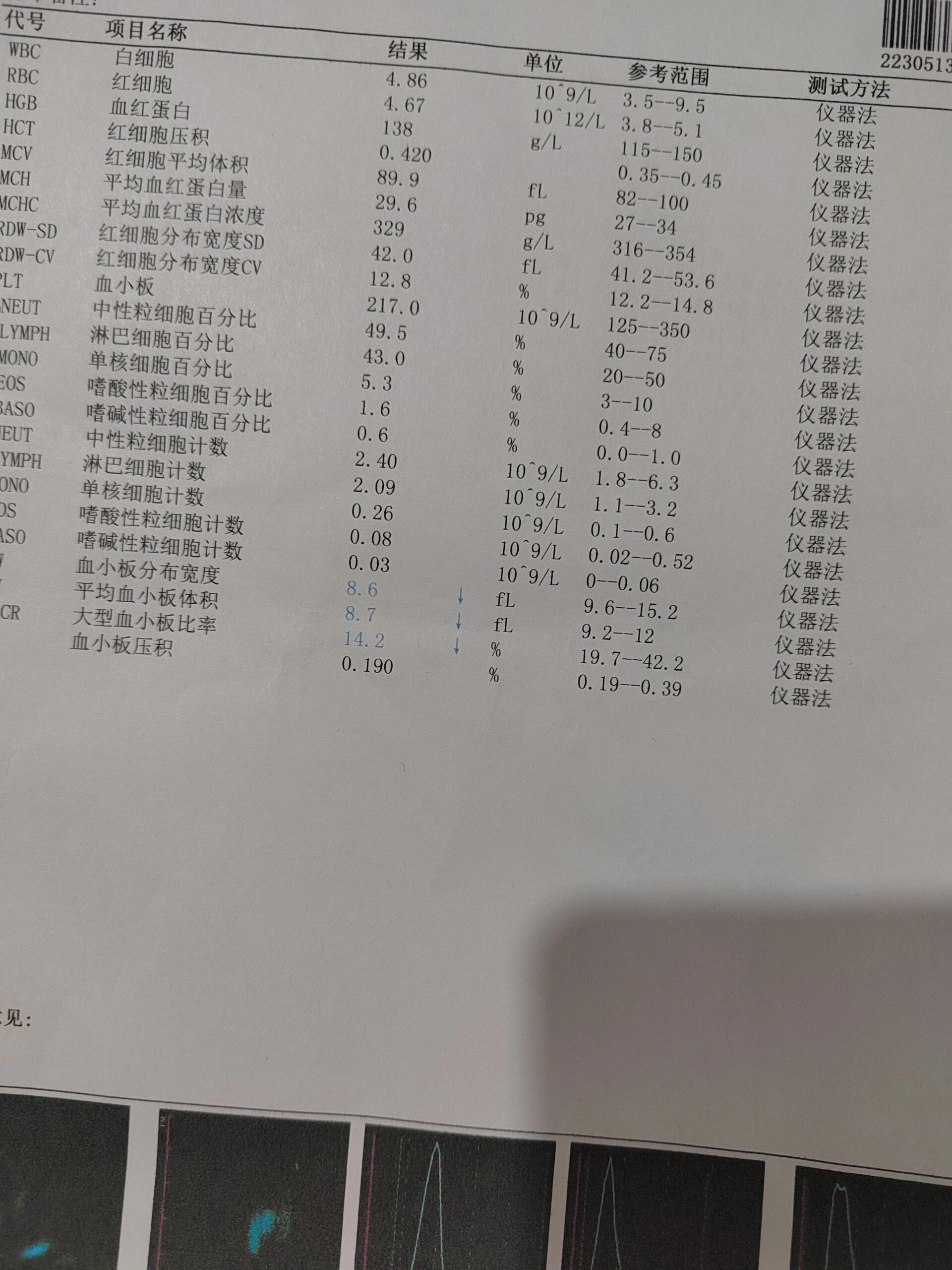 大型血小板比率低,血小板体积低