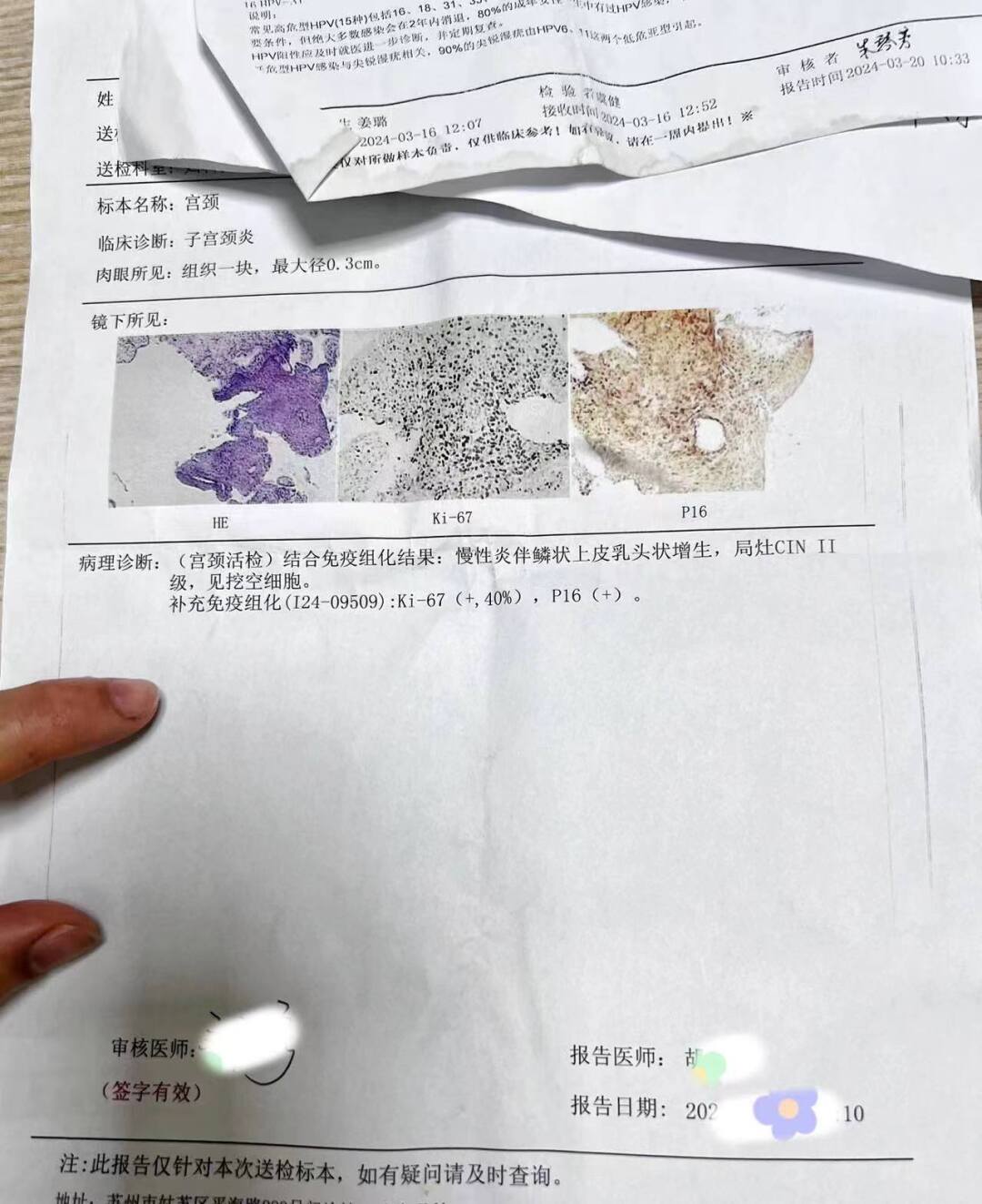 cin2级了,手术一定是首选吗?