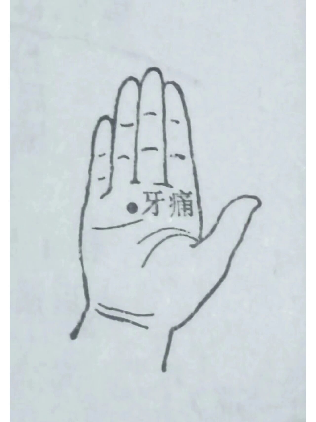 牙疼奇穴 治疗各种牙痛经外奇穴牙痛穴: 位置67在手掌面 第三,四