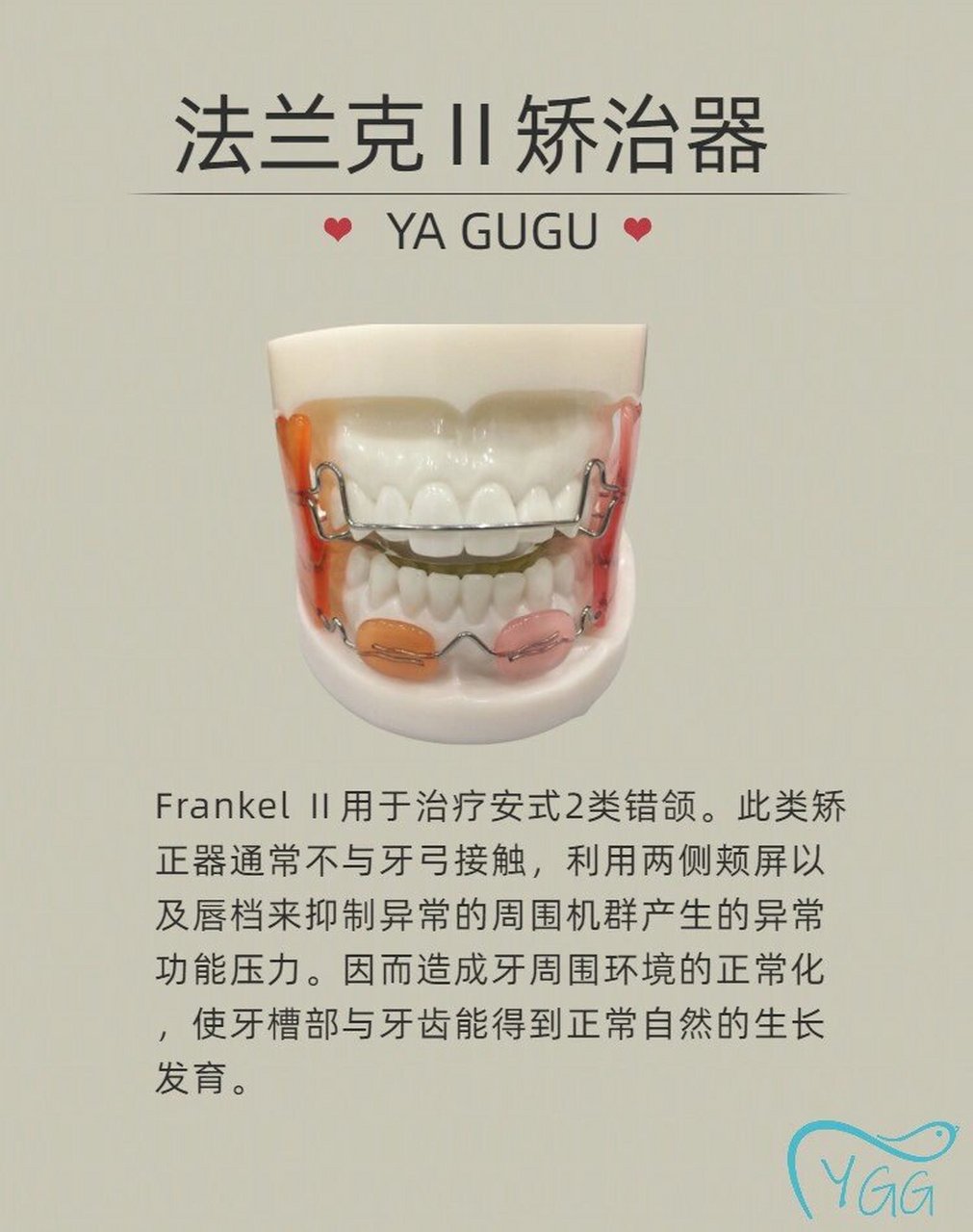 今日学习:法兰克2⃣️ 法兰克frankel Ⅱ 用于治疗安式2类错颌.