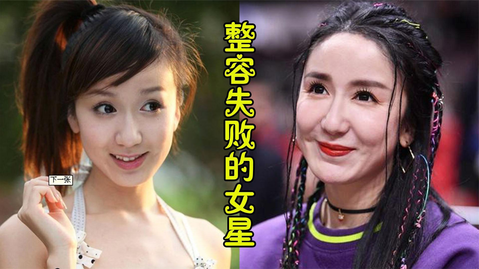 整容失败的女星王丽坤素颜女神彻底整垮张檬取出假体美上巅峰