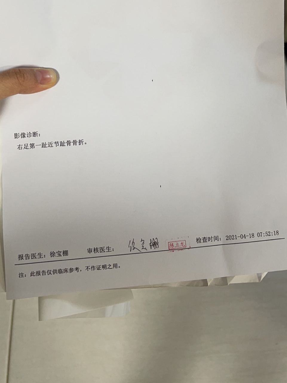 脚趾头骨折的第9天 就飞来横祸,离家门口还有两三步楼梯的时候摔了