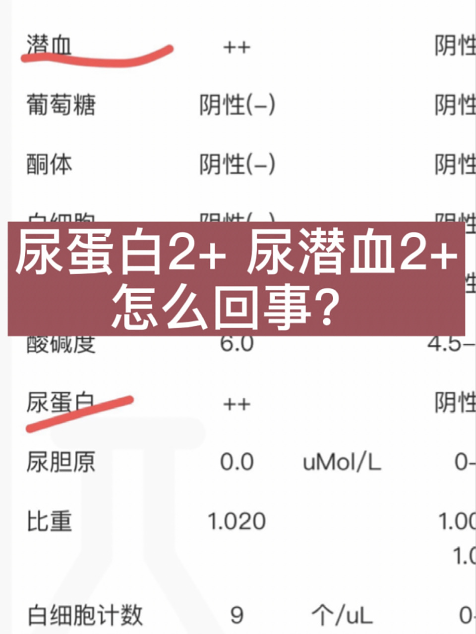 最近很多人问,尿蛋白2  尿潜血2 怎么回事? 这个往往提示有肾脏损 ..