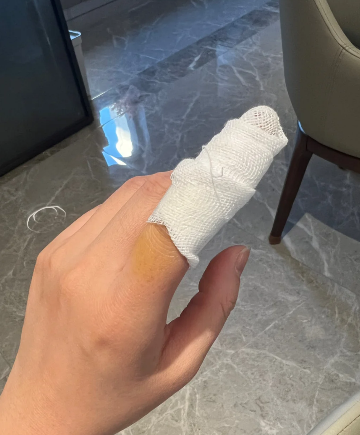 手指被切掉一块肉连带半片指甲时,先别慌