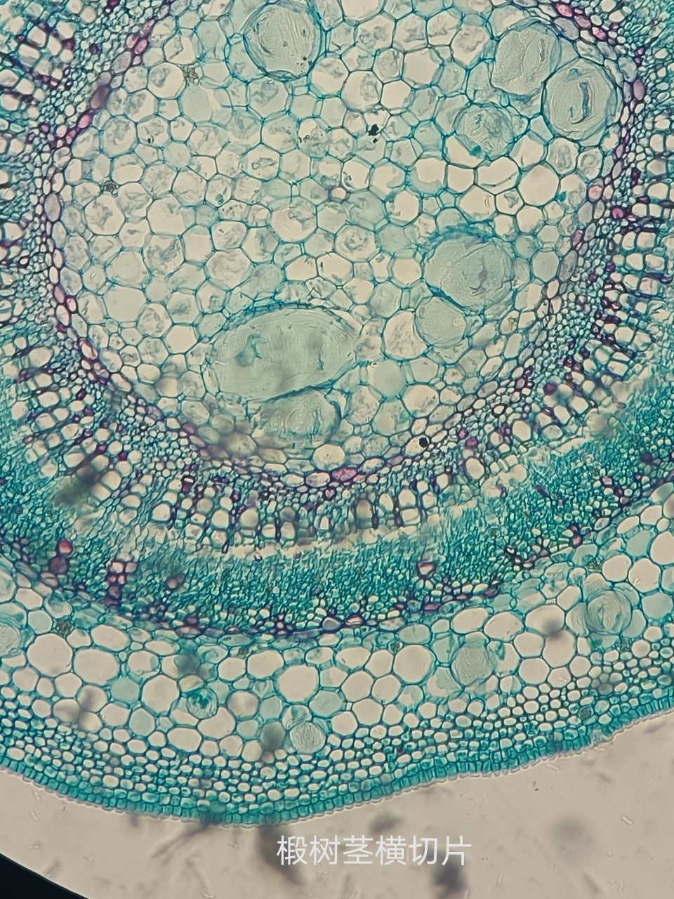 椴树茎横切片显微结构图