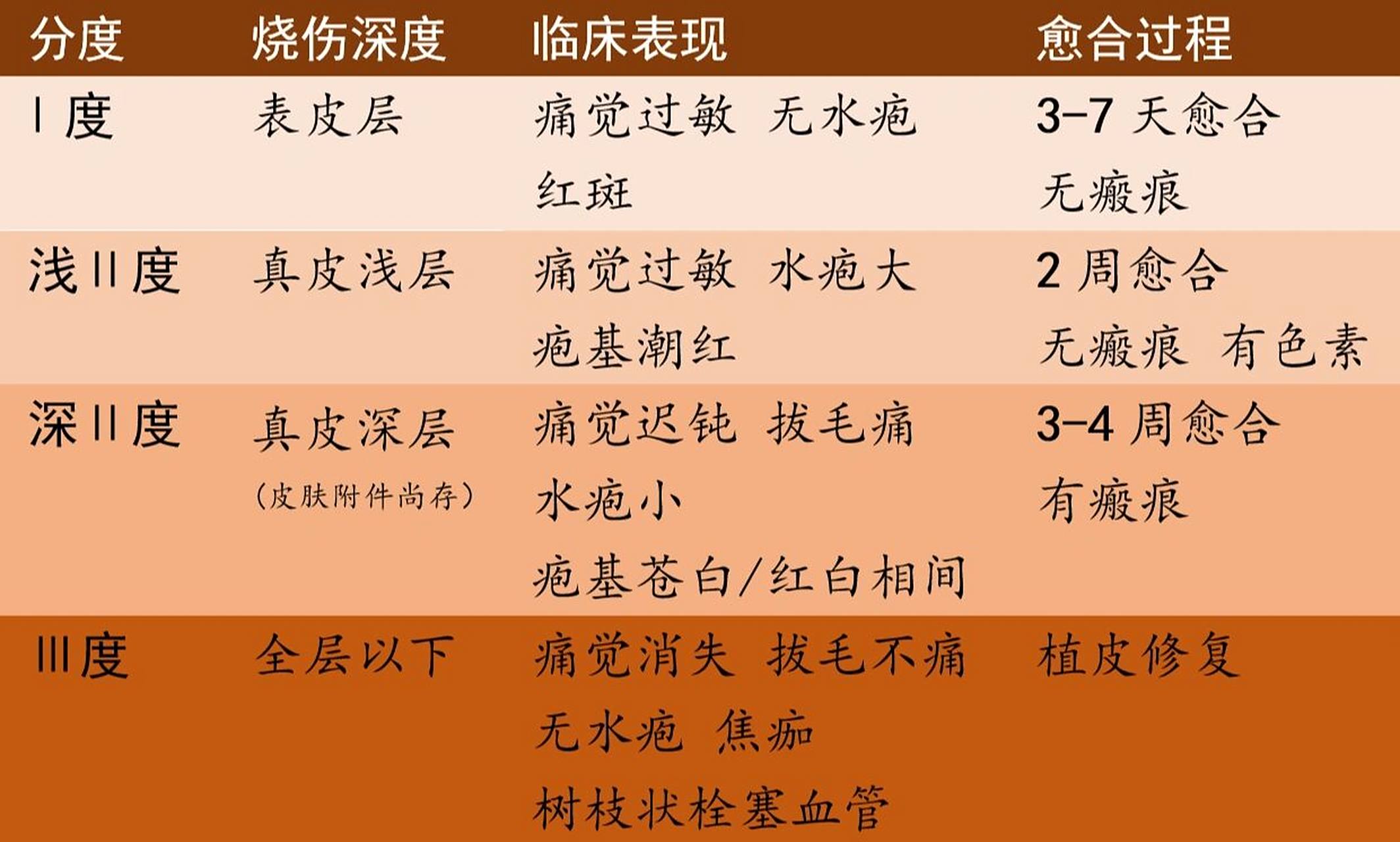 烧伤的临床表现,程度分级,补液治疗 烧伤泛指由热力(如火焰,热液,热