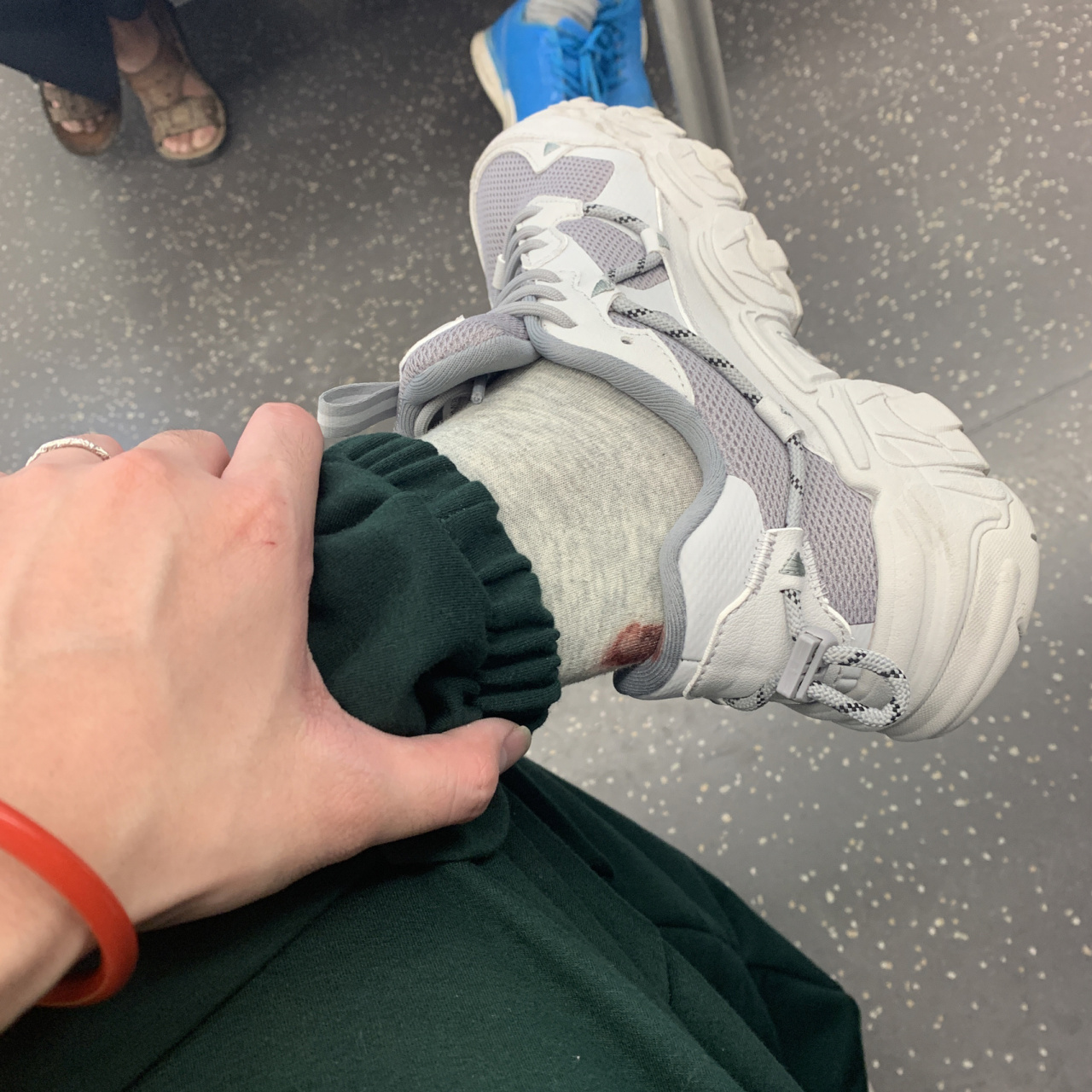 鞋子打脚06怎么办!来我来教你 最近出差,更新较慢 .