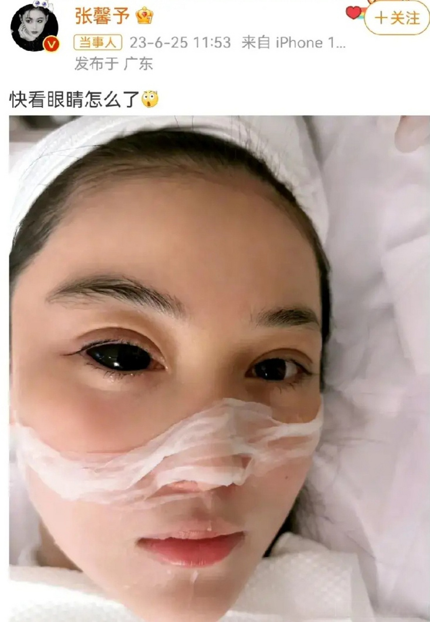 张馨予说自己戴了一个超级大的美瞳,戴美瞳眼镜会变成这样吗?