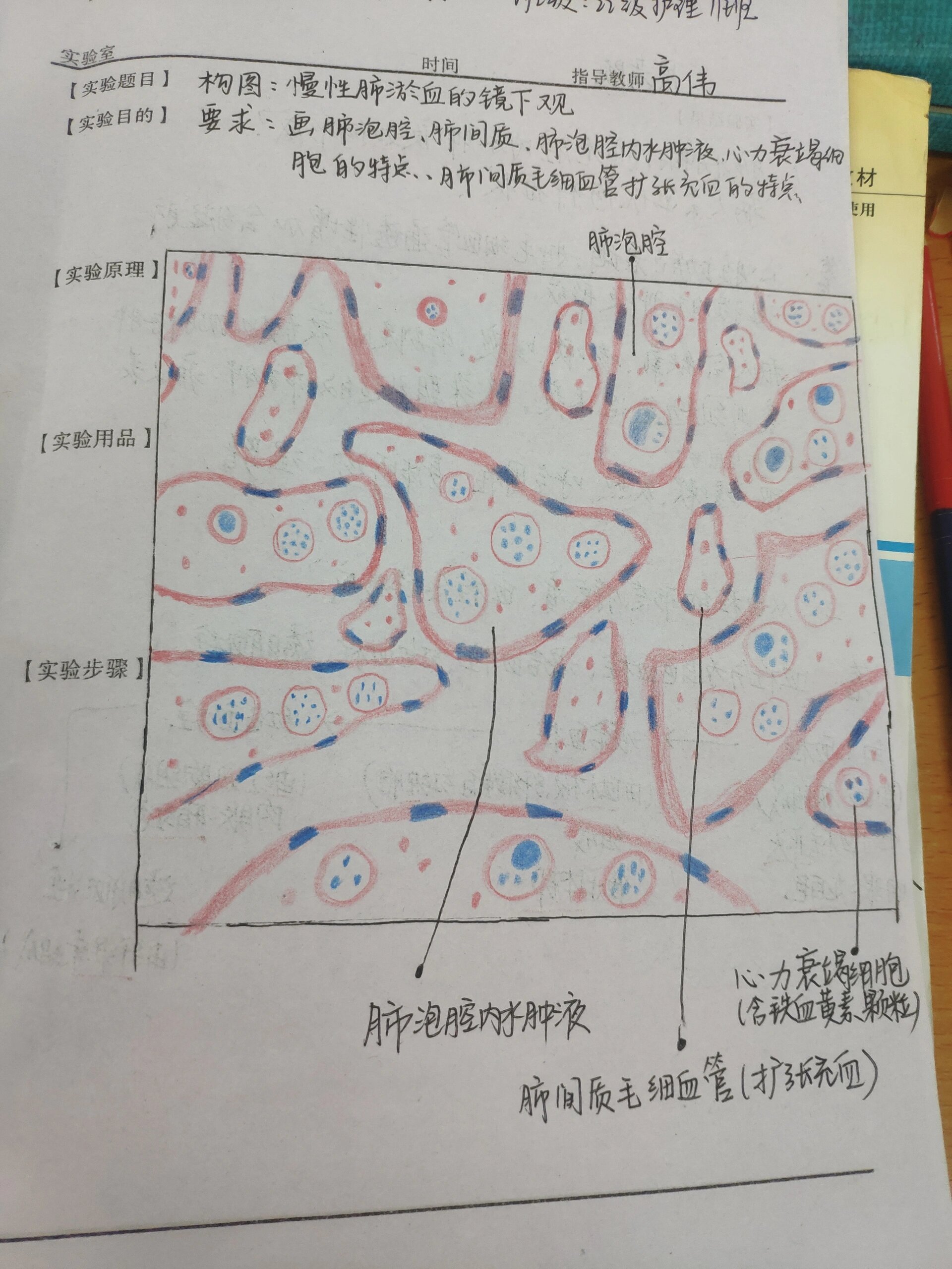 肺淤血病理作业图图片