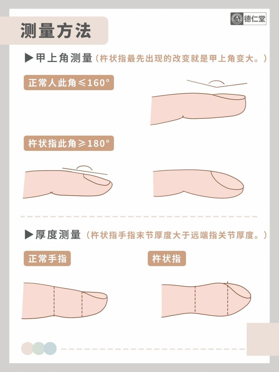 杵状指健康自测 | 1分钟肺癌等疾病检查指南 宝子们,今天堂主给大家