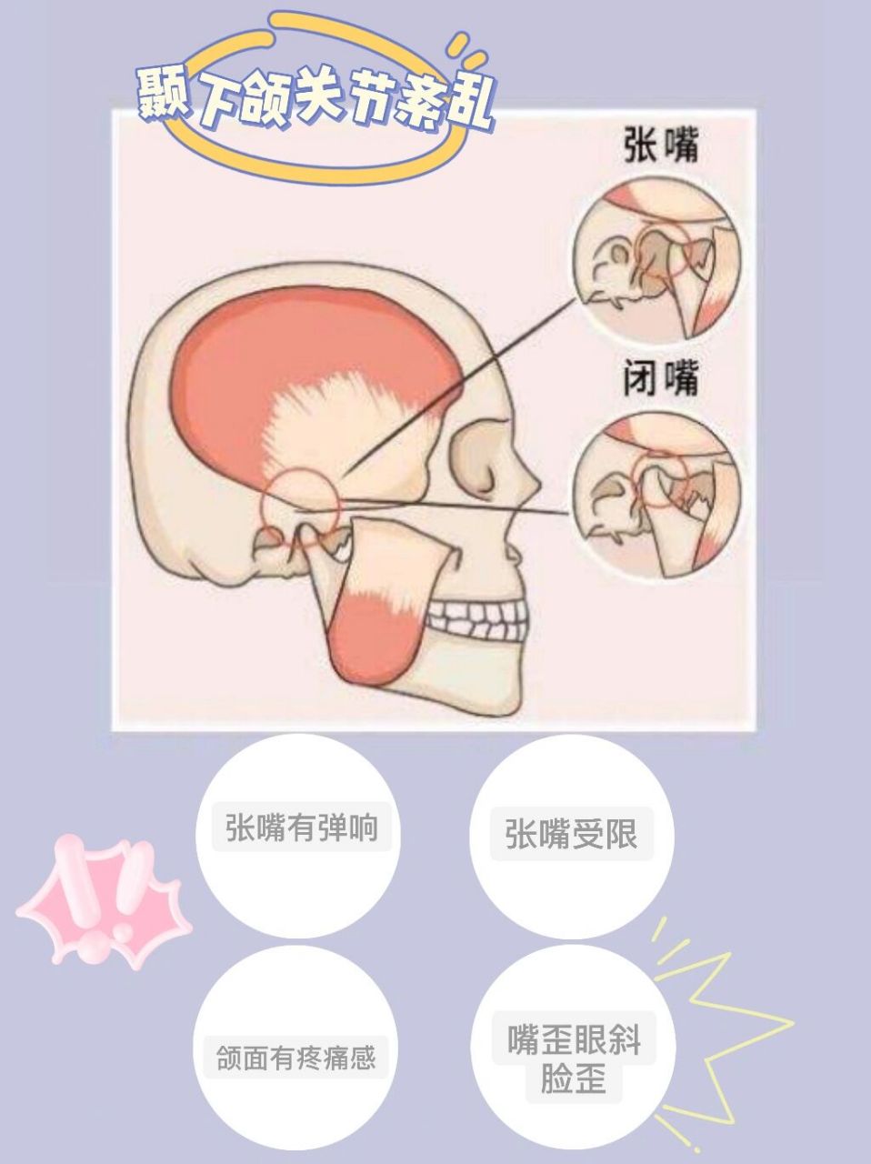 颞下颌关节紊乱的一些科普.