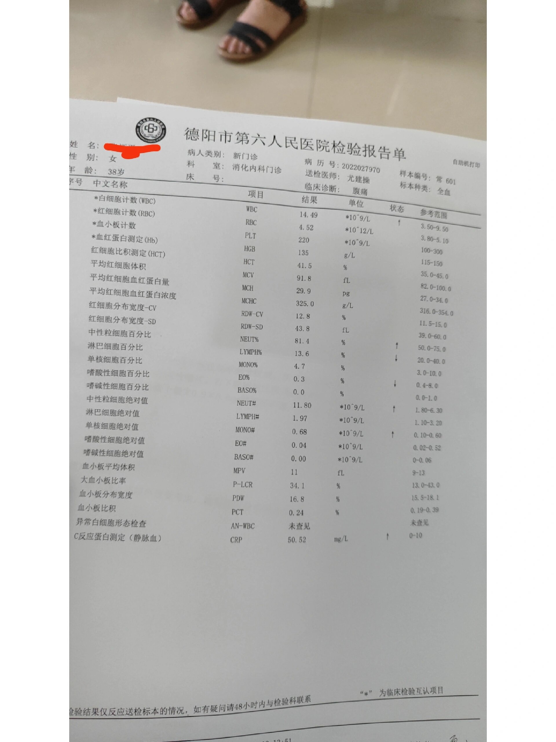 急性阑尾炎报告图片