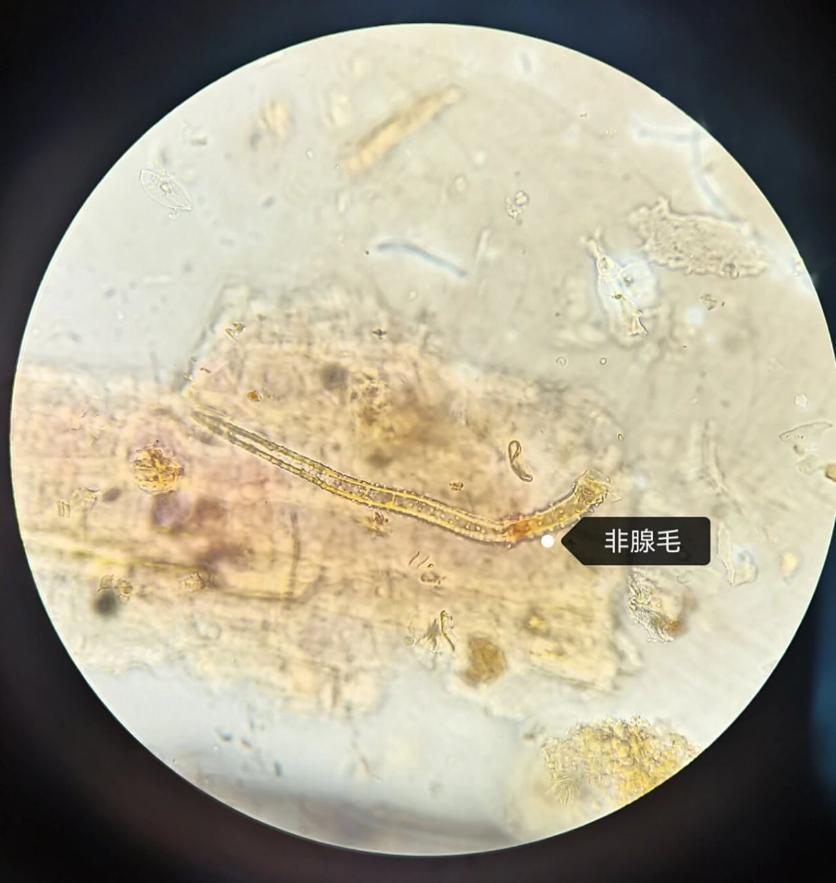 薄荷粉末显微鉴别 1.非腺毛 2.气孔 3.橙皮苷结晶 4.腺鳞