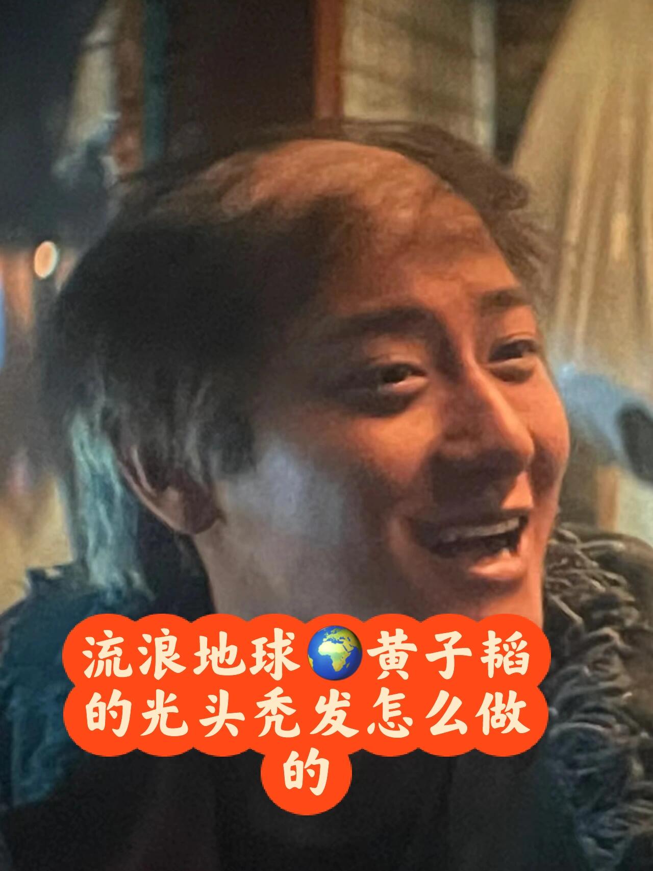 黄子韬的头顶冒险:秃头也有春天🌸