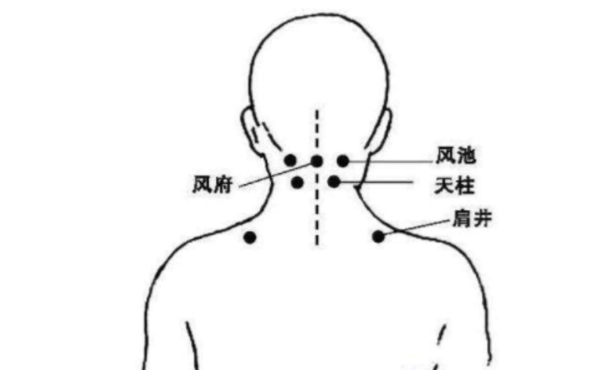 风池和天柱的位置图图片