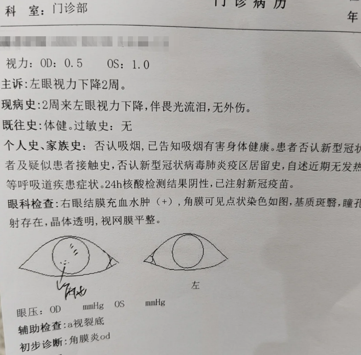 眼睛为什么会模糊 眼睛为什么会模糊