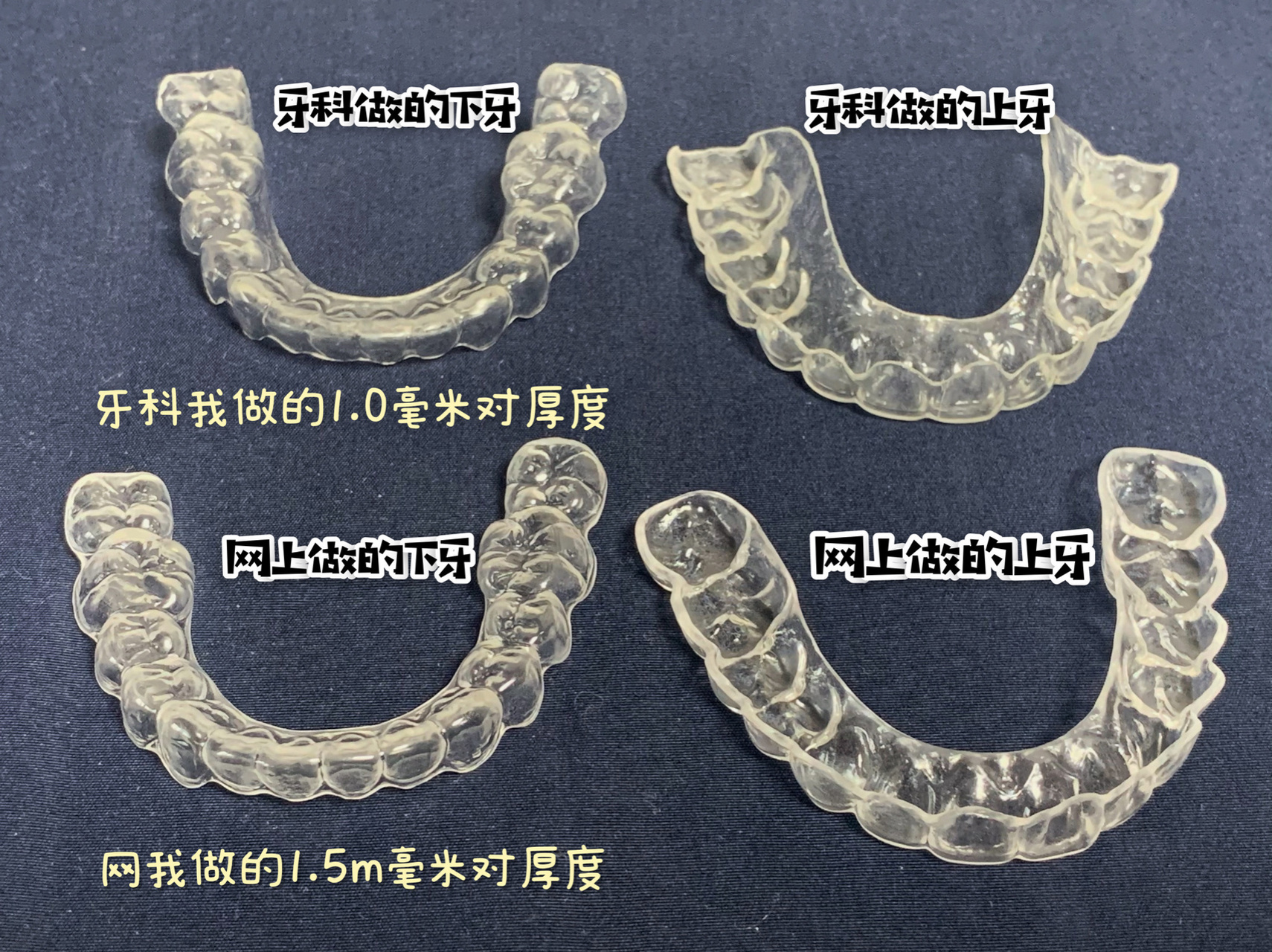 钢丝保持器佩戴图片图片