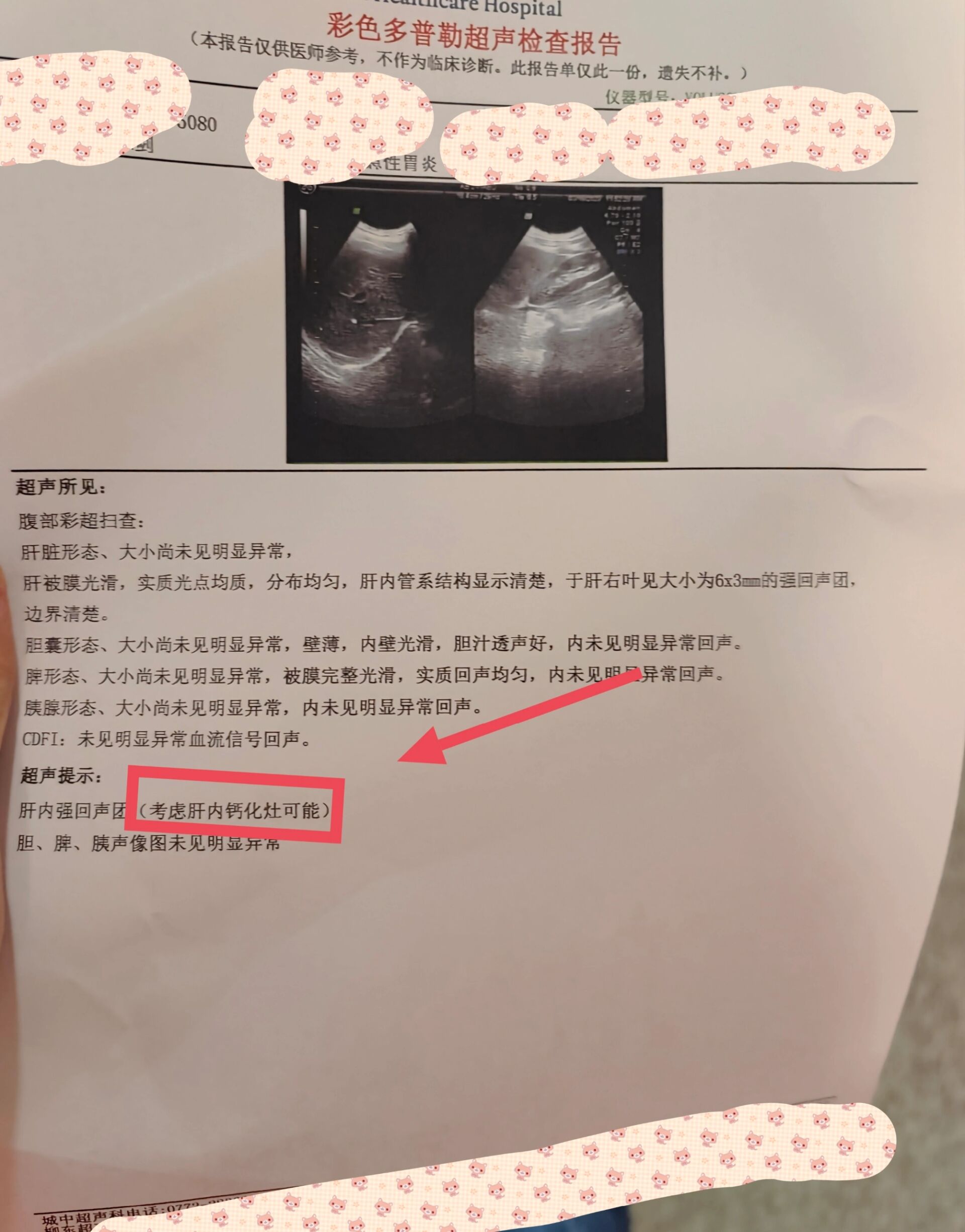 肝内钙化灶 急剧胃痛,医生叫抽血和拍b超看是否为胰腺炎 结果出来后